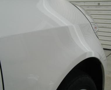 デントリペア AFTER